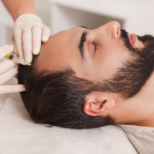 Sapphire FUE hair transplant procedure at HDA Clinic Bryanston
