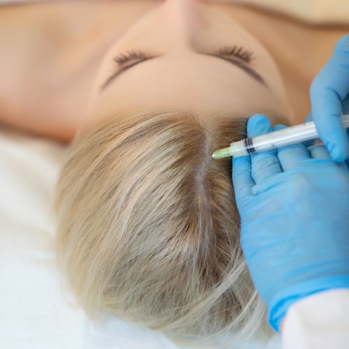 Carboxy therapy for hair loss at HDA Clinic