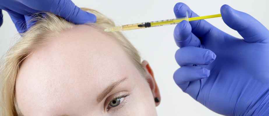 Hair Transplant for Women